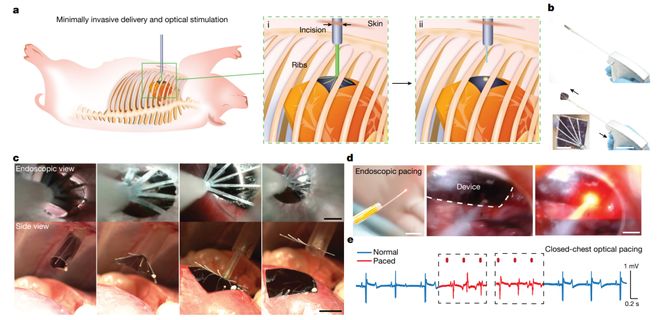 光电生物调控迎重要进展：科学家起搏成年活体猪心脏比上一代材料效率提高约25倍(图9)