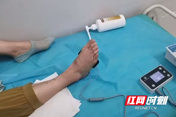 小便功能“丢失”这项技术助力排尿自由(图1)