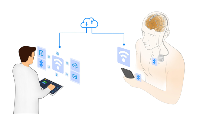瑞神安医疗“植入式脑深部神经刺激器系统（CNS）”正式获批上市(图1)