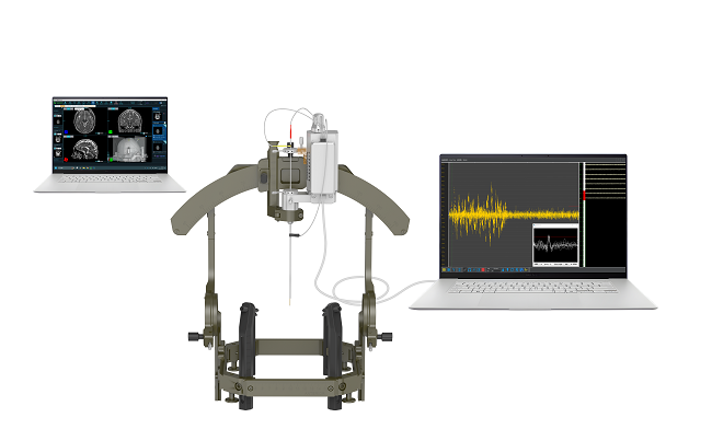 瑞神安医疗“植入式脑深部神经刺激器系统（CNS）”正式获批上市(图3)