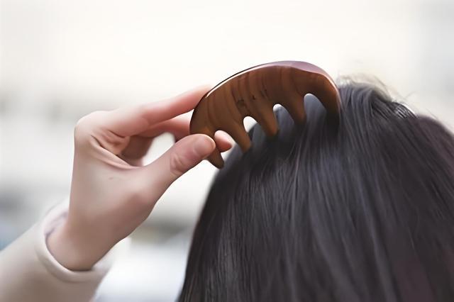 告别油腻与稀疏：脂溢性脱发生发全攻略重拾形象尊严！(图4)