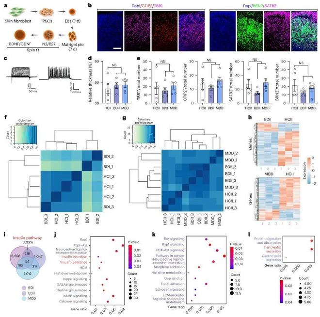 清华大学最新研究揭示胰腺-海马反馈机制调控抑郁相关行为的昼夜节律变化(图2)