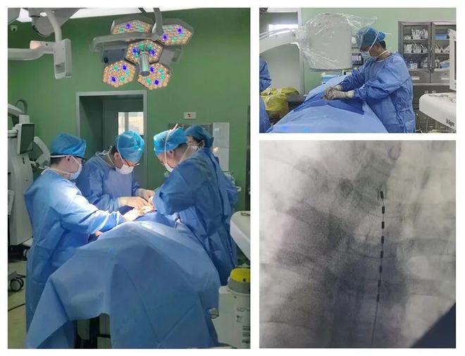 融资近2亿！国产神经调控进入“无线化竞赛”(图3)