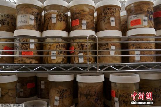 中国人民大学王亚培教授AM：仿生聚光器实现深层组织无线神经刺激(图1)