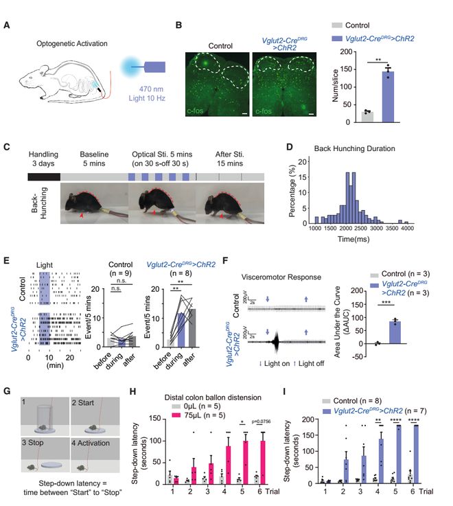Neuron｜肠道神经如何向大脑喊疼？倪金飞段树民唐逸泉团队揭示小鼠内感受和内脏痛的肠-背根神经节通路(图4)