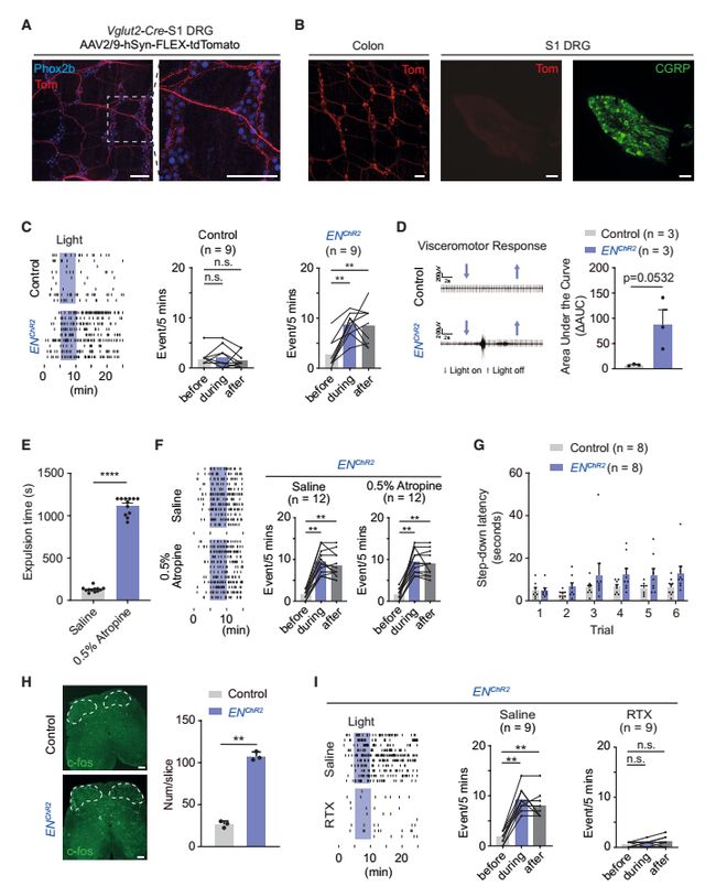 Neuron｜肠道神经如何向大脑喊疼？倪金飞段树民唐逸泉团队揭示小鼠内感受和内脏痛的肠-背根神经节通路(图5)