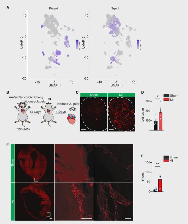 《Cell》靶向心脑轴：心梗精准治疗的新方向！(图3)