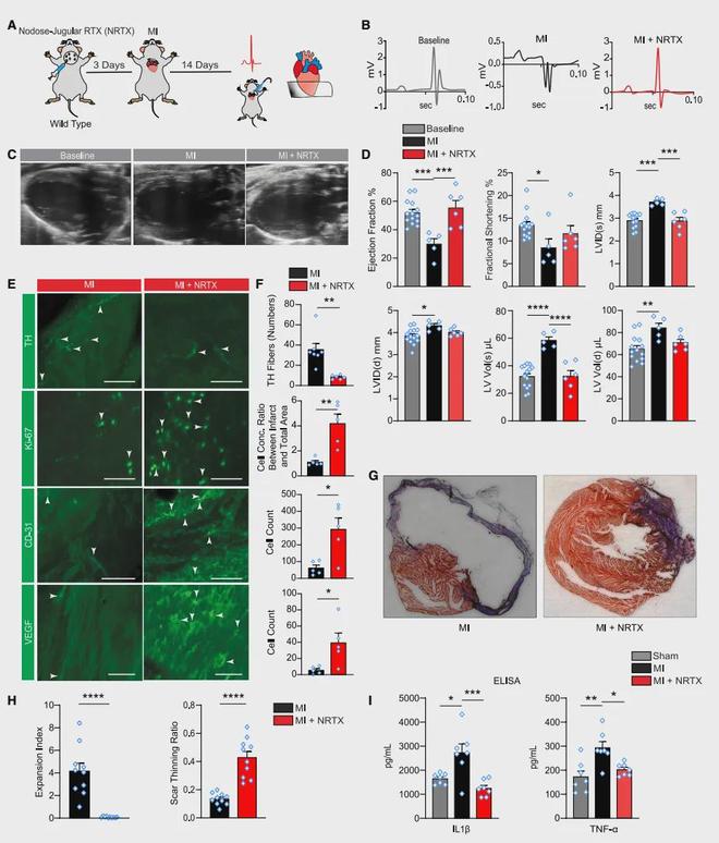 《Cell》靶向心脑轴：心梗精准治疗的新方向！(图4)